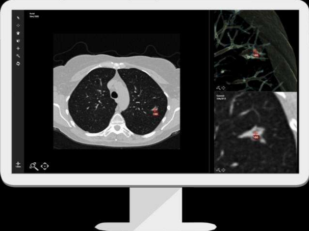 AI算法晶振,贴片有源晶振